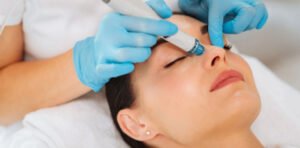 Hydra Facial at Vida Beauty Clinic Lebanon